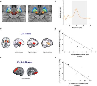 Subthalamic Beta Activity in Parkinson's Disease May Be Linked to Dorsal Striatum Gray Matter Volume and Prefrontal Cortical Thickness: A Pilot Study